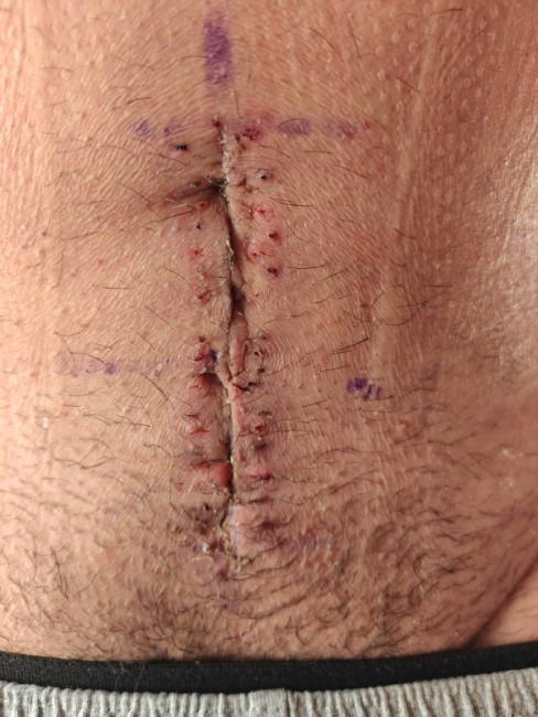 Franchement le chir aurait pu être plus précis.